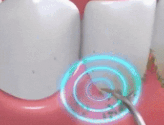 Ultrazvukový čistič zubů SMILY